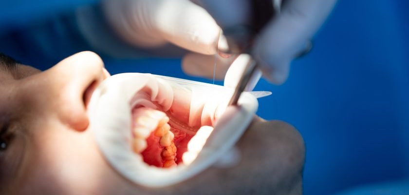 pacient in dental clinic while operation